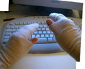 bandaged-handsjpg.jpg